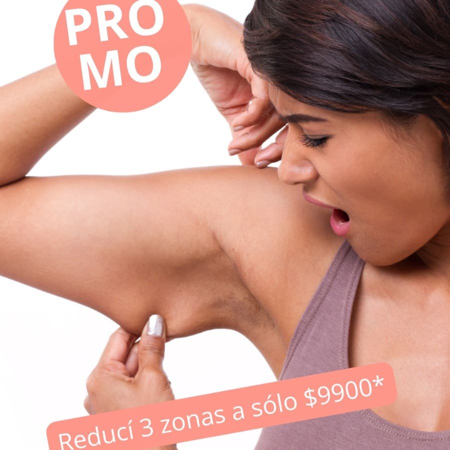 CRIOLIPOLISIS TEXEL SUCCION COOLSCOOLPING